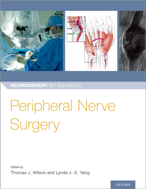 Peripheral Nerve Surgery, PDF eBook