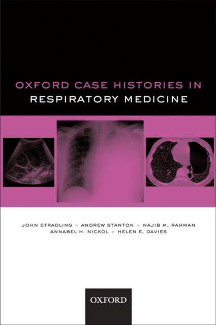 Oxford Case Histories in Respiratory Medicine, PDF eBook