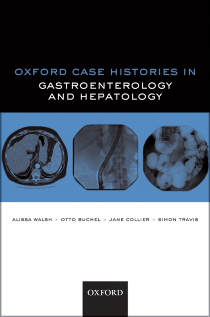 Oxford Case Histories in Gastroenterology and Hepatology, PDF eBook
