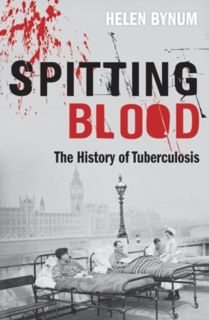 Spitting Blood : The history of tuberculosis, PDF eBook