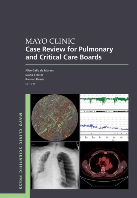 Mayo Clinic Case Review for Pulmonary and Critical Care Boards, Paperback / softback Book