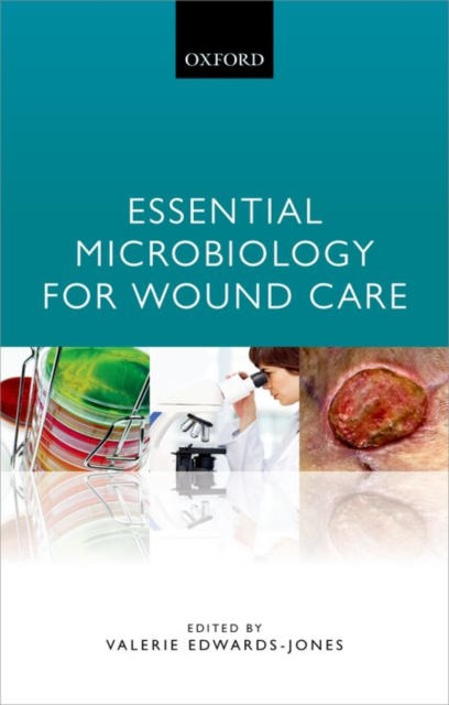 Essential Microbiology for Wound Care, Paperback / softback Book