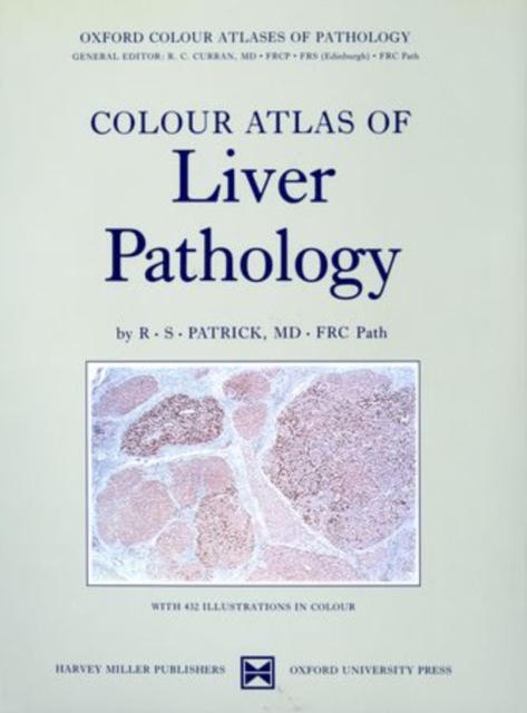 Colour Atlas of Liver Pathology, Hardback Book