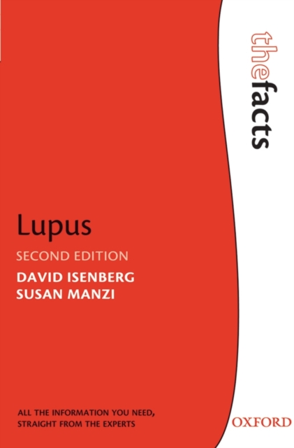 Lupus, Paperback / softback Book