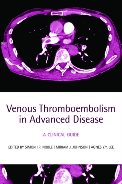 Venous Thromboembolism in Advanced Disease : A clinical guide, Paperback / softback Book
