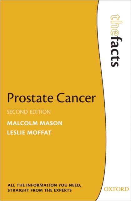 Prostate Cancer, Paperback / softback Book