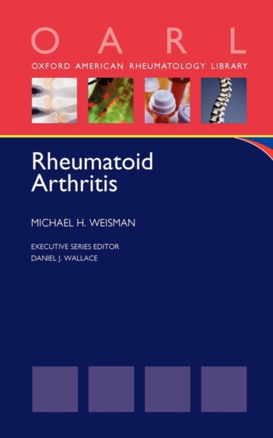 Rheumatoid Arthritis, Paperback / softback Book