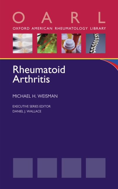 Rheumatoid Arthritis, PDF eBook