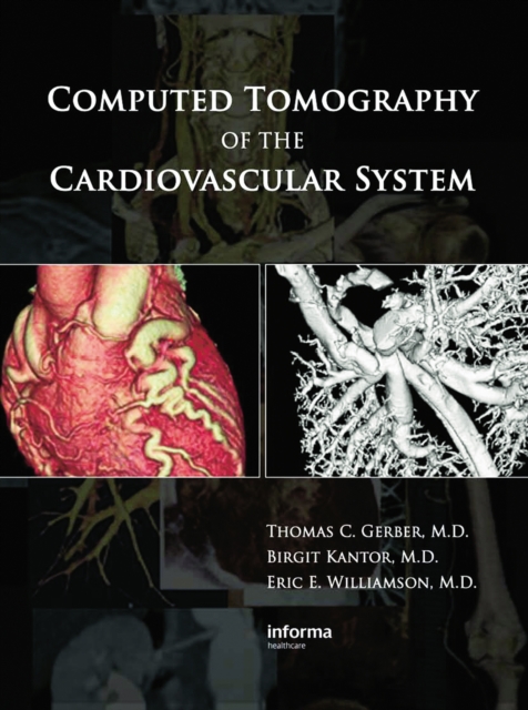 Computed Tomography of the Cardiovascular System, PDF eBook