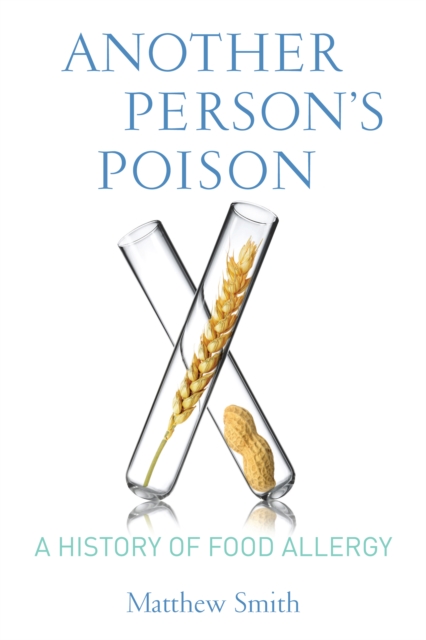 Another Person's Poison : A History of Food Allergy, EPUB eBook