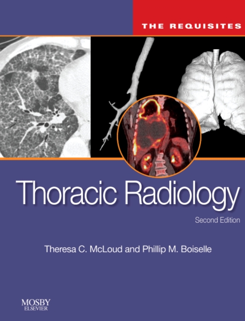 Thoracic Radiology: The Requisites, Hardback Book