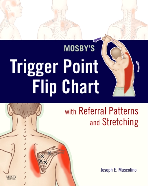 Mosby's Trigger Point Flip Chart with Referral Patterns and Stretching, Poster Book