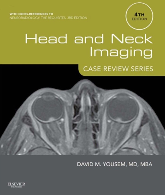 Head and Neck Imaging: Case Review Series E-Book : Head and Neck Imaging: Case Review Series E-Book, EPUB eBook