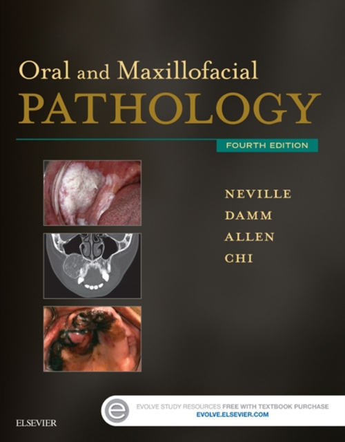 Oral and Maxillofacial Pathology - E-Book : Oral and Maxillofacial Pathology - E-Book, EPUB eBook
