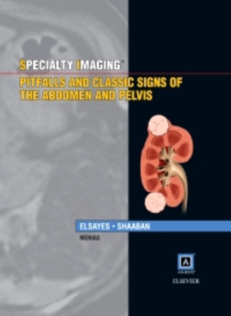 Specialty Imaging: Pitfalls and Classic Signs of the Abdomen and Pelvis E-Book : Specialty Imaging: Pitfalls and Classic Signs of the Abdomen and Pelvis E-Book, PDF eBook
