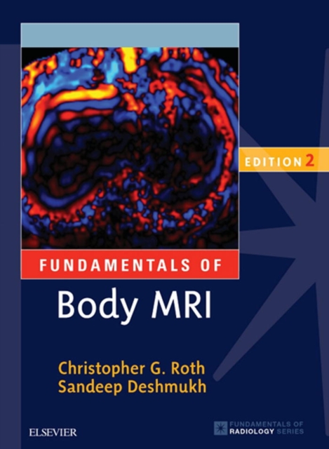 Fundamentals of Body MRI E-Book, EPUB eBook