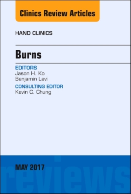Burns, An Issue of Hand Clinics : Volume 33-2, Hardback Book