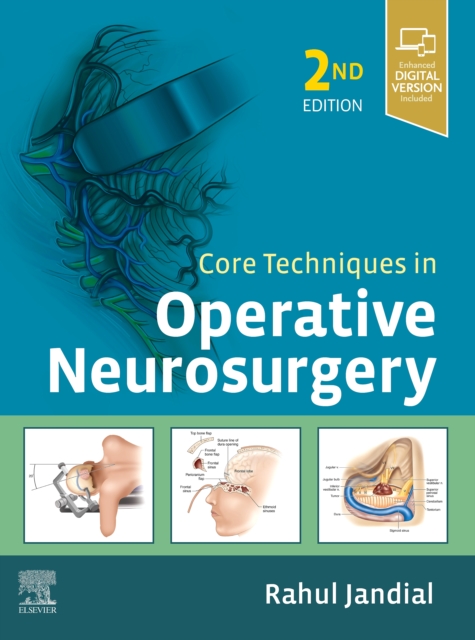 Core Techniques in Operative Neurosurgery E-Book, EPUB eBook