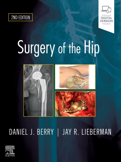 Surgery of the Hip, Hardback Book