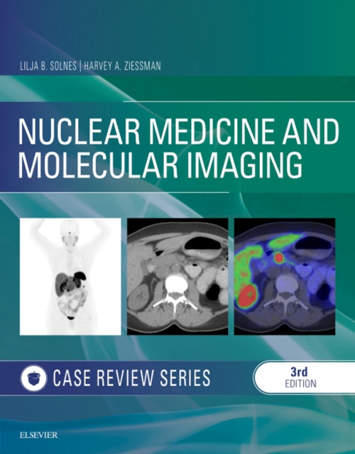 Nuclear Medicine and Molecular Imaging: Case Review Series E-Book : Nuclear Medicine and Molecular Imaging: Case Review Series E-Book, EPUB eBook