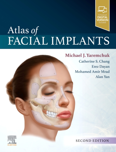 Atlas of Facial Implants, Hardback Book Atlas of Facial Implants, Hardback Book