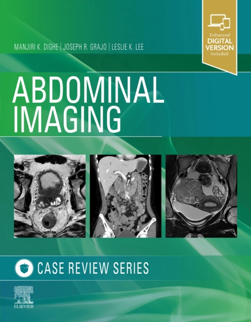 Abdominal Imaging : Case Review Series, Paperback / softback Book