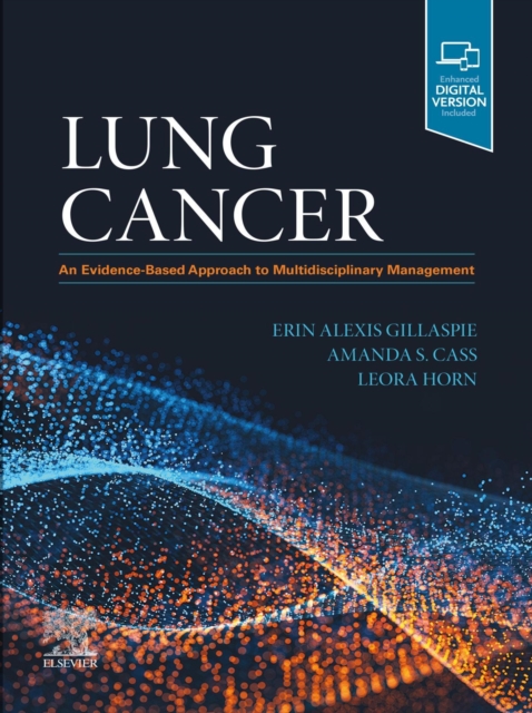 Lung Cancer : An Evidence-Based Approach to Multidisciplinary Management, EPUB eBook