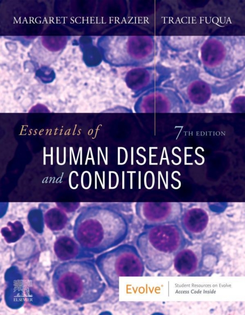 Essentials of Human Diseases and Conditions - E-Book : Essentials of Human Diseases and Conditions - E-Book, EPUB eBook