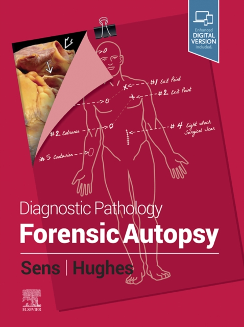 Diagnostic Pathology: Forensic Autopsy E-Book : Diagnostic Pathology: Forensic Autopsy E-Book, EPUB eBook