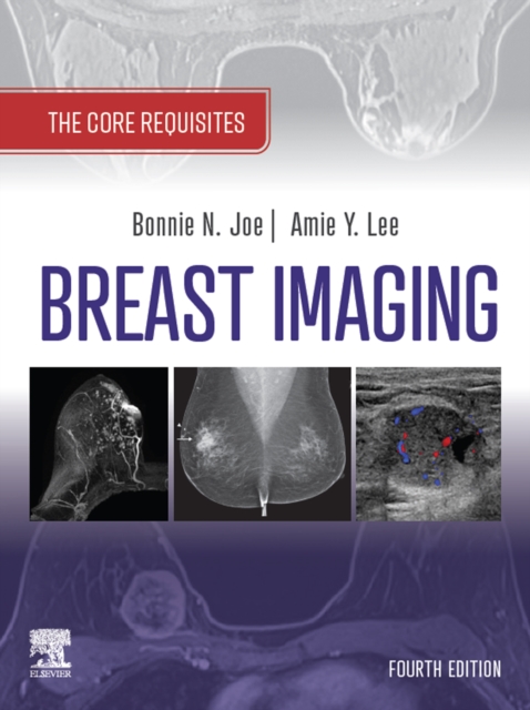 Breast Imaging, E-Book : The Core Requisites, EPUB eBook