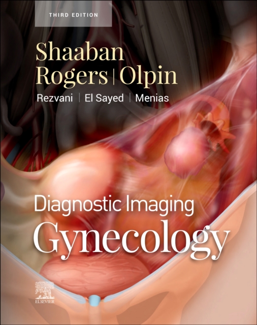 Diagnostic Imaging: Gynecology - E-Book : Diagnostic Imaging: Gynecology - E-Book, EPUB eBook
