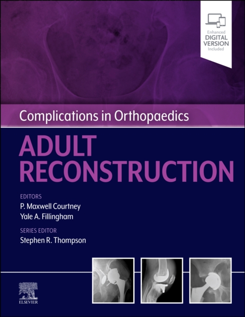 Complications in Orthopaedics: Adult Reconstruction, Hardback Book