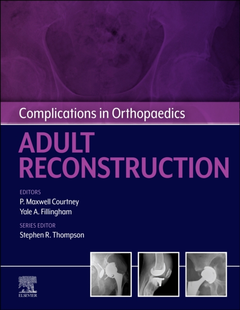 Complications in Orthopaedics: Adult Reconstruction - E-Book, EPUB eBook