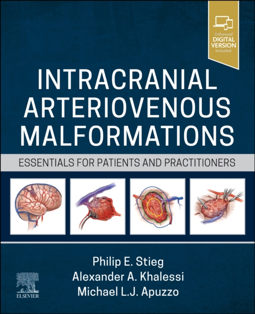 Intracranial Arteriovenous Malformations : Essentials for Patients and Practitioners, Hardback Book