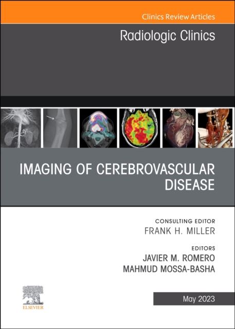 Imaging of Cerebrovascular Disease, An Issue of Radiologic Clinics of North America : Volume 61-3, Hardback Book