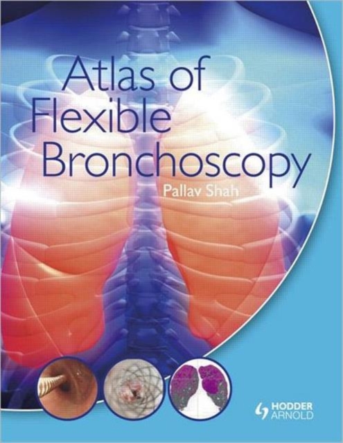 Atlas of Flexible Bronchoscopy, Hardback Book