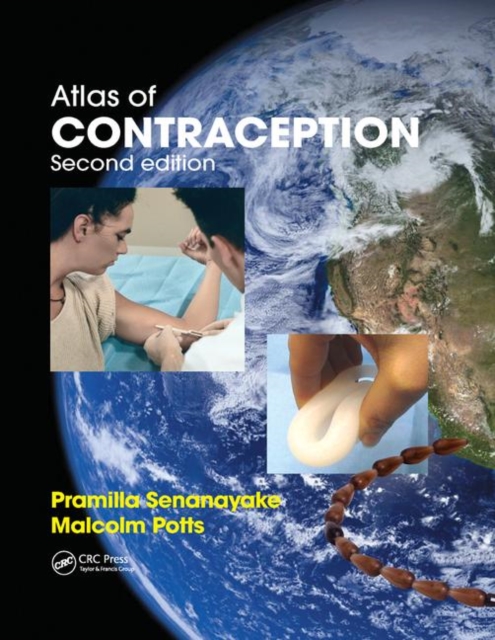 Atlas of Contraception, Paperback / softback Book