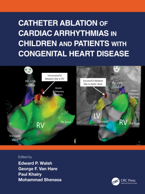 Catheter Ablation of Cardiac Arrhythmias in Children and Patients with Congenital Heart Disease, Hardback Book