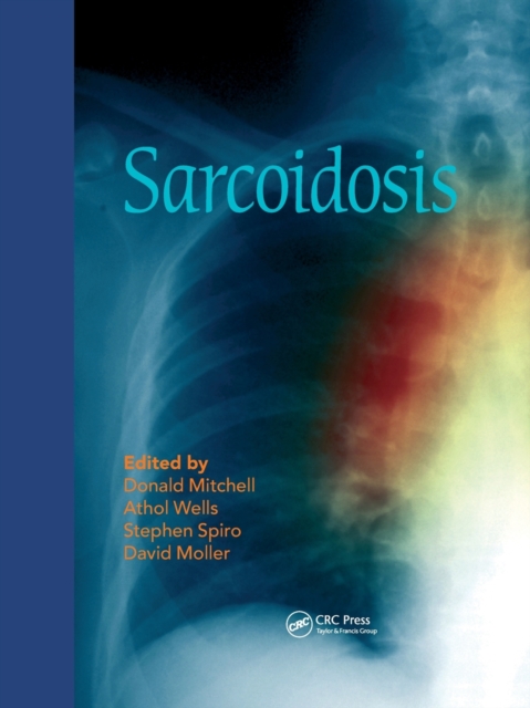 Sarcoidosis, Paperback / softback Book