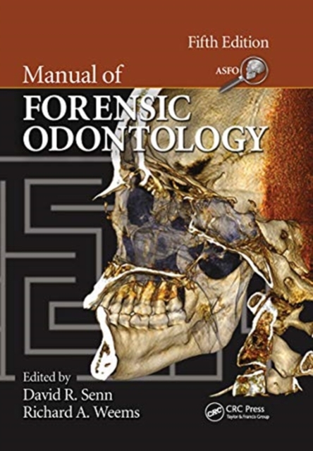Manual of Forensic Odontology, Paperback / softback Book