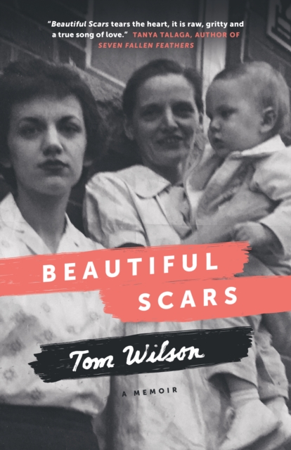 Beautiful Scars, EPUB eBook