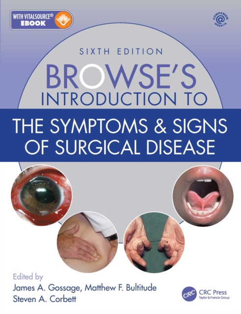 Browse's Introduction to the Symptoms & Signs of Surgical Disease, EPUB eBook