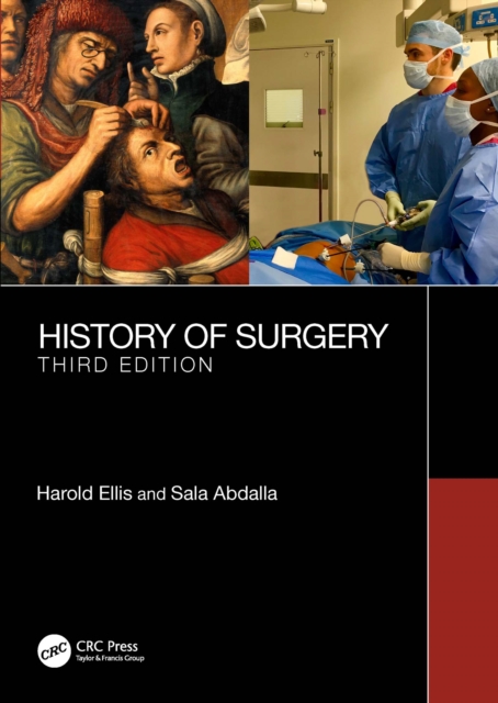 A History of Surgery : Third Edition, PDF eBook