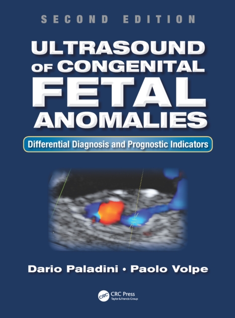 Ultrasound of Congenital Fetal Anomalies : Differential Diagnosis and Prognostic Indicators, Second Edition, EPUB eBook