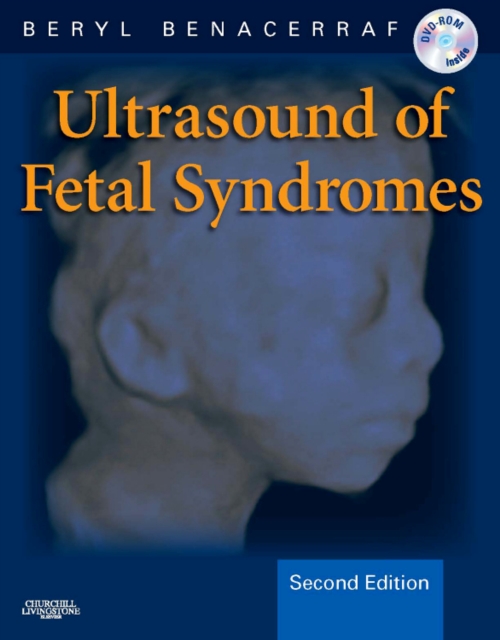 Ultrasound of Fetal Syndromes, Mixed media product Book