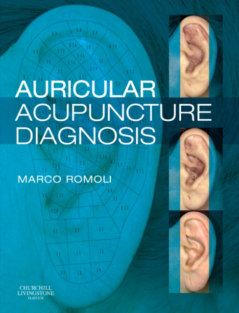 Auricular Acupuncture Diagnosis, Hardback Book