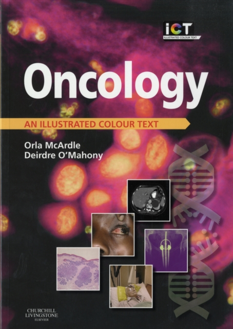 Oncology : An Illustrated Colour Text, Paperback Book