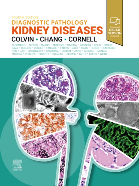 Diagnostic Pathology: Kidney Diseases E-Book, EPUB eBook