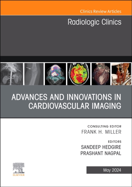 Advances and Innovations in Cardiovascular Imaging, An Issue of Radiologic Clinics of North America : Volume 62-3, Hardback Book