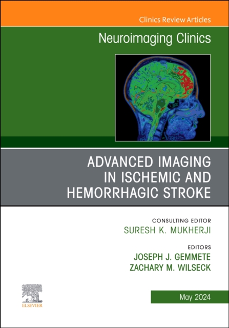 Advanced Imaging in Ischemic and Hemorrhagic Stroke, An Issue of Neuroimaging Clinics of North America : Volume 34-2, Hardback Book